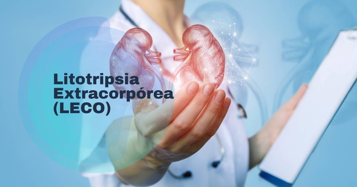 litotripsia-extracorpórea-leco